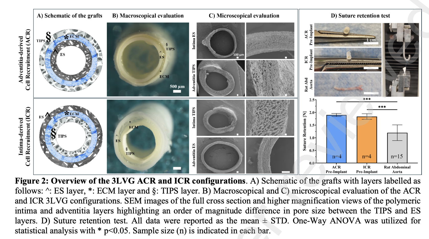Overview of three-layer vascular graft configurations